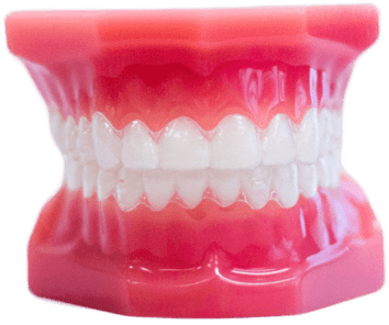 Invisalign