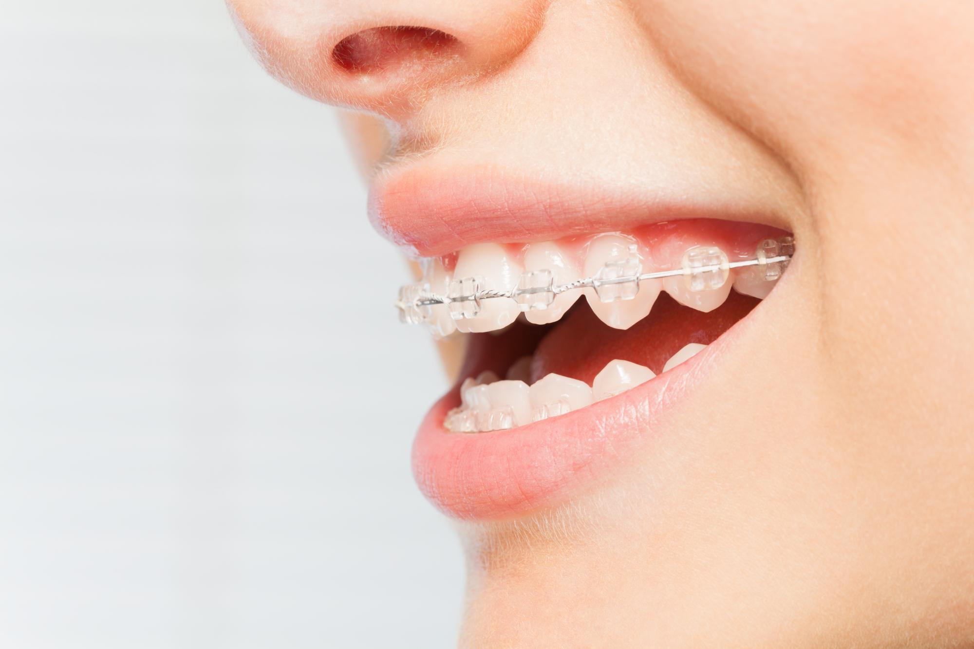 orthodontics martinsburg