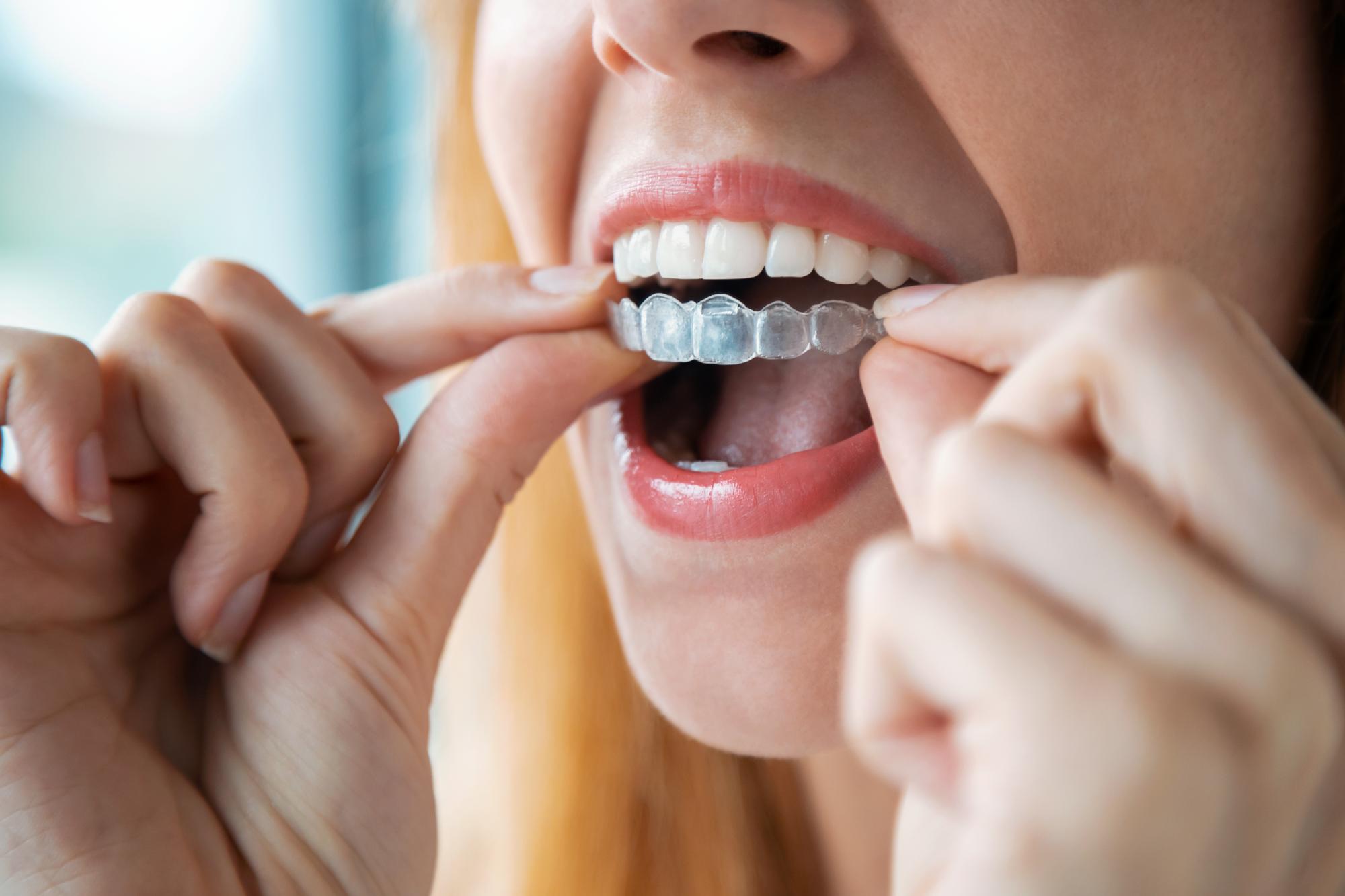 orthodontics martinsburg