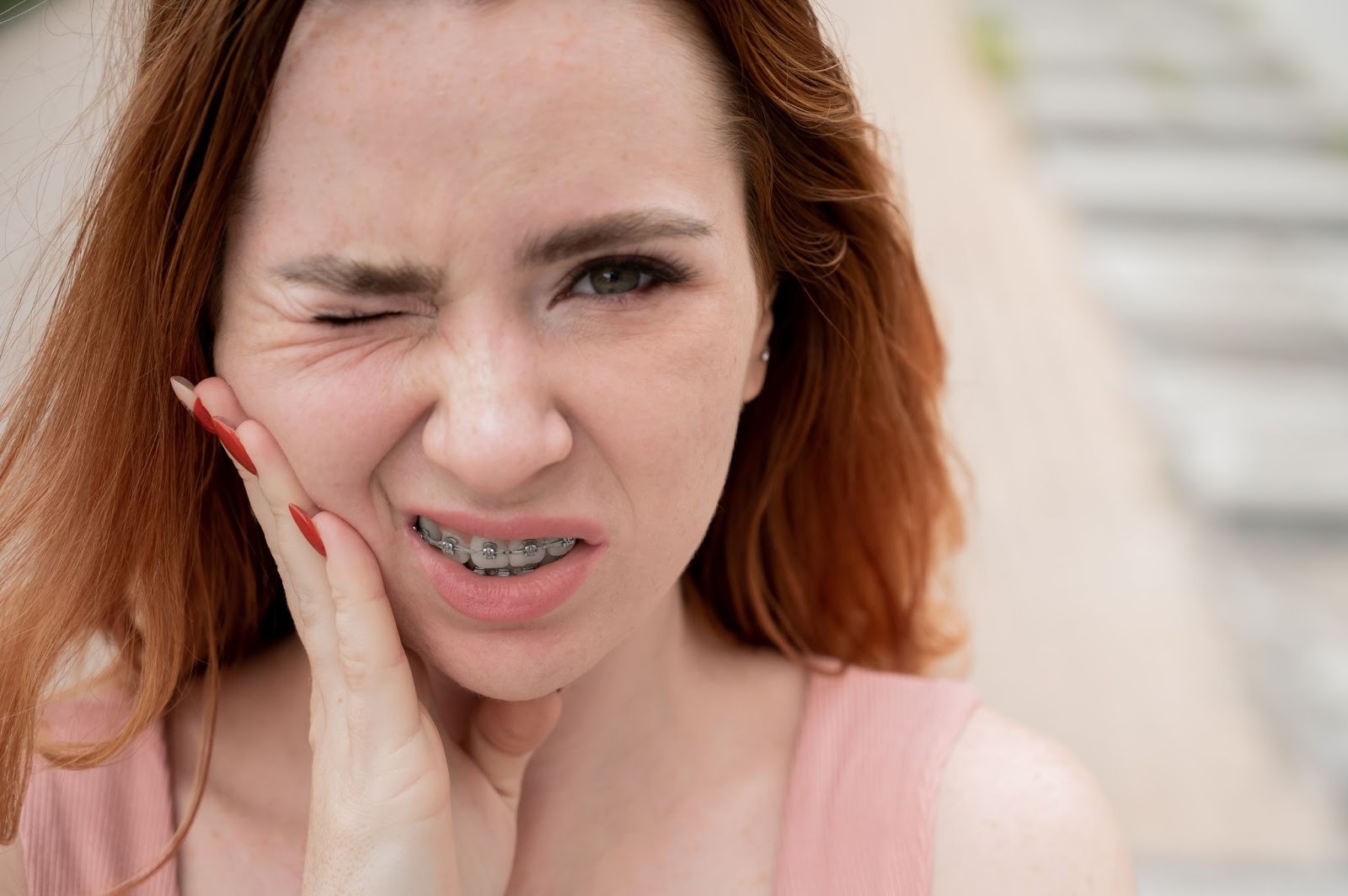 5 Tips for Preventing Orthodontic Emergencies