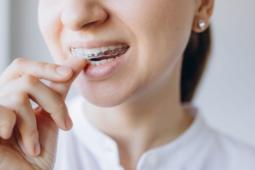 5 Tips for Preventing Orthodontic Emergencies